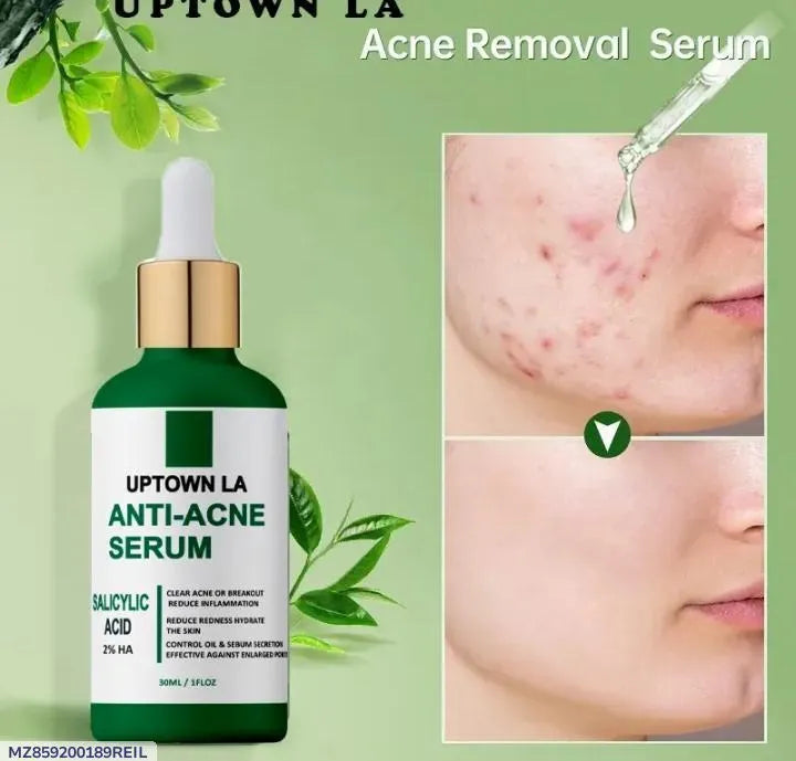 Anti-acne face serum for daily skincare
