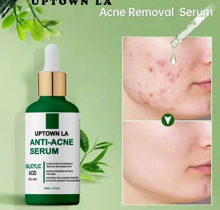 Facial serum for blemish-prone skin