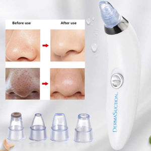 Derma suction facial spa pore cleaner in Pakistan
